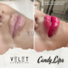 VV Lips - Image 4